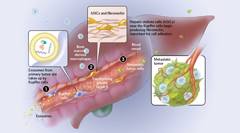 Cancer’s Vanguard: Exosomes are emerging as key players in metastasis - QED Bioscience, Inc