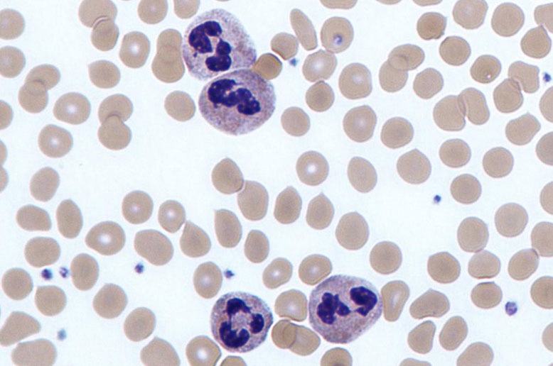 Group B Streptococcus: New Insights into Toxicity - QED Bioscience, Inc