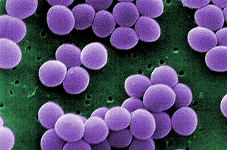 Staph. vs. Staph - QED Bioscience, Inc