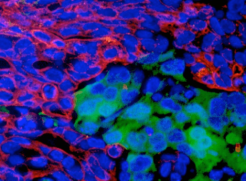 How To Obtain Stellar Staining with Fluorescent IHC - QED Bioscience, Inc