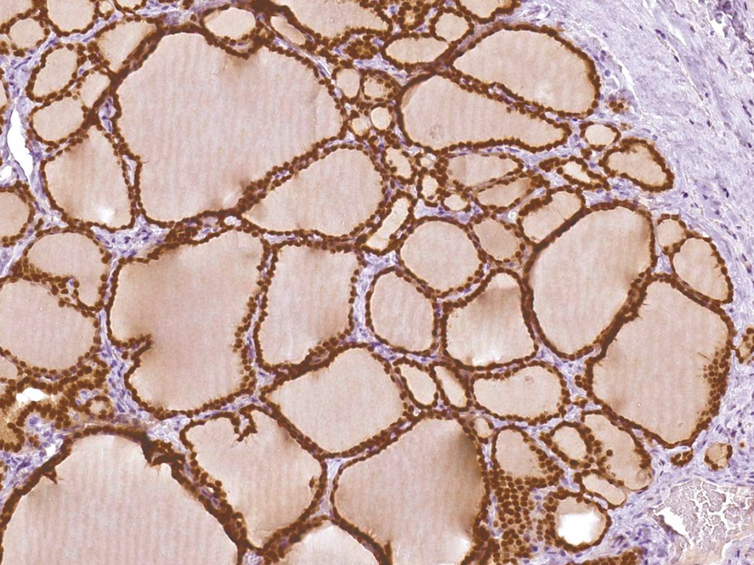 IHC Troubleshooting - QED Antibodies