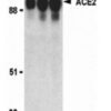 Anti-Angiotensin Converting Enzyme 2 (ACE2)