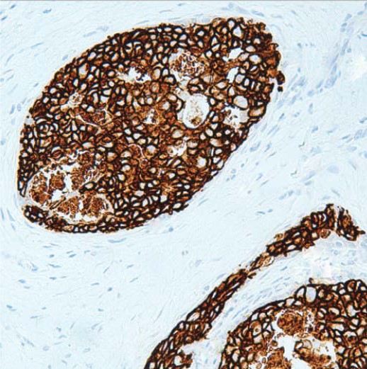 AntiHer2/Neu Antibody QED Bioscience Inc