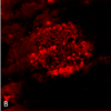 Immunohistochemistry analysis using Rabbit Anti-Amyloid Fibrils (OC) Polyclonal Antibody (57005). Tissue: Alzheimer's Disease brain. Species: Human. Fixation: Formalin fixed. Primary Antibody: Rabbit Anti-Amyloid Fibrils (OC) Polyclonal Antibody (57005) at 1:5000. Secondary Antibody: Goat Anti-Rabbit ATTO 488 (green). Localization: Plaque. (A) Amyloid Fibril (OC) Antibody (57005). (B) Amyloid Oligomer (A11) Antibody (57006). (C) Composite. Courtesy of: Dr. Elizabeth Head