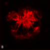 Immunohistochemistry analysis using Rabbit Anti-Amyloid Oligomers (A11) Polyclonal Antibody (57006). Tissue: Alzheimer's Disease brain. Species: Human. Fixation: Formalin fixed. Primary Antibody: Rabbit Anti-Amyloid Oligomers (A11) Polyclonal Antibody (57006) at 1:1000. Secondary Antibody: Goat Anti-Rabbit ATTO 594 (red). Localization: Plaque. (A) Amyloid Fibril (OC) Antibody (57005). (B) Amyloid Oligomer (A11) Antibody (57006). (C) Composite. Courtesy of: Dr. Elizabeth Head