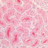 Immunohistochemistry analysis using Rabbit Anti-Tau Polyclonal Antibody (57010). Tissue: Kidney. Species: Human. Fixation: Formalin fixed paraffin-embedded. Primary Antibody: Rabbit Anti-Tau Polyclonal Antibody (57010).